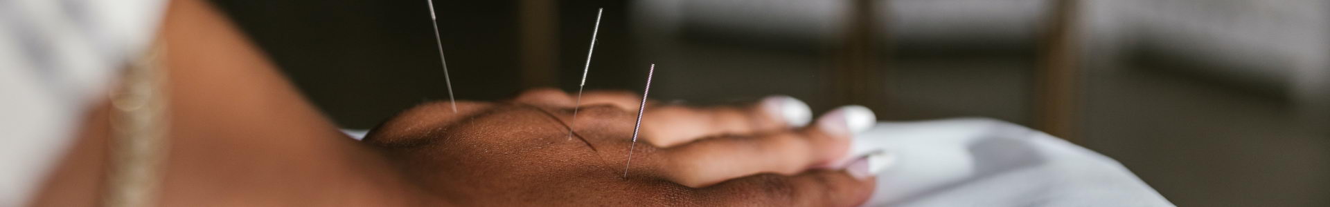 Acupuncture